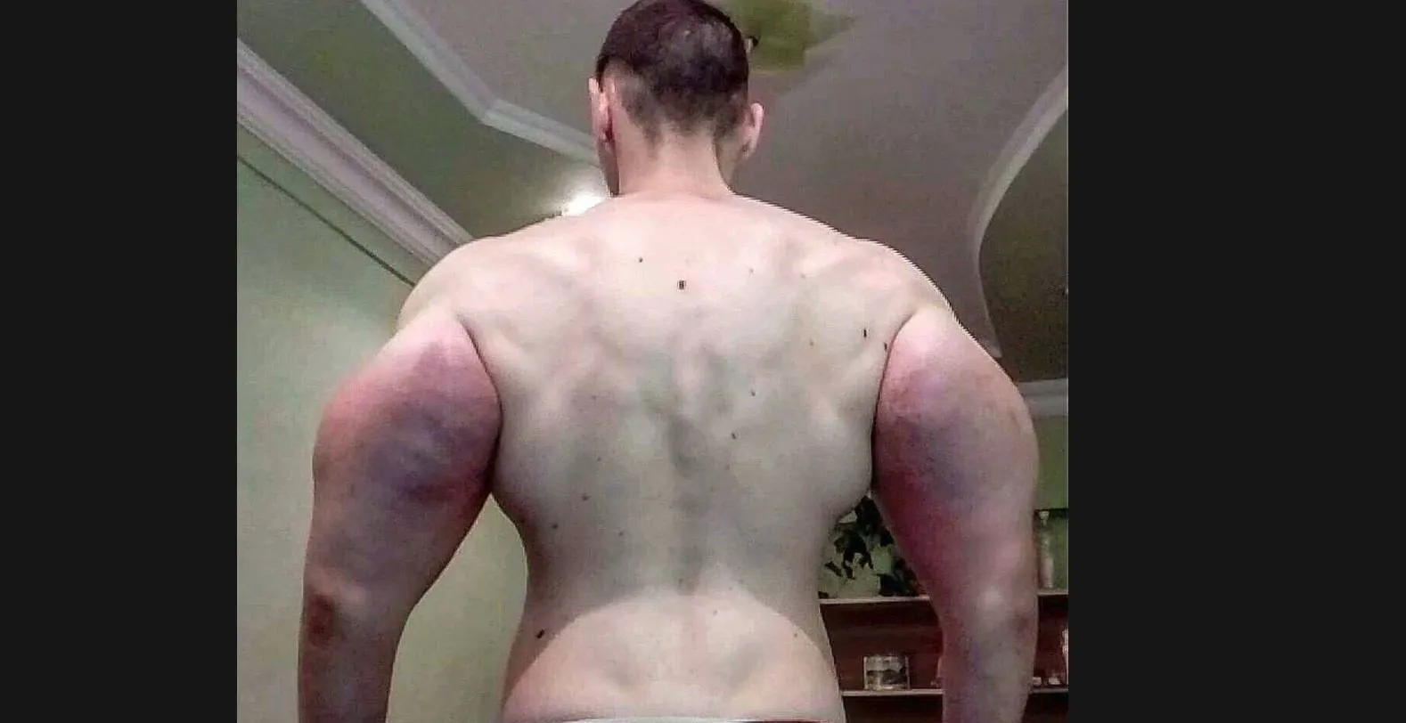 وفاة «باباي البرازيلي» بعد صراع صحي مرير.. حقن تضخيم العضلات تقود لاعب كمال الأجسام إلى النهاية